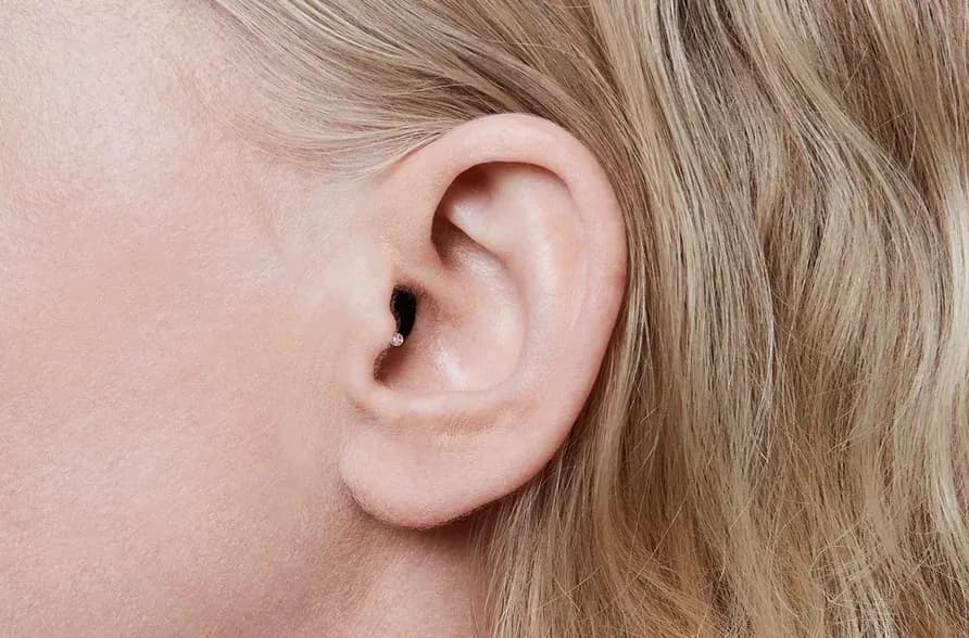 Wewnętrzny aparat słuchowy, mity i fakty